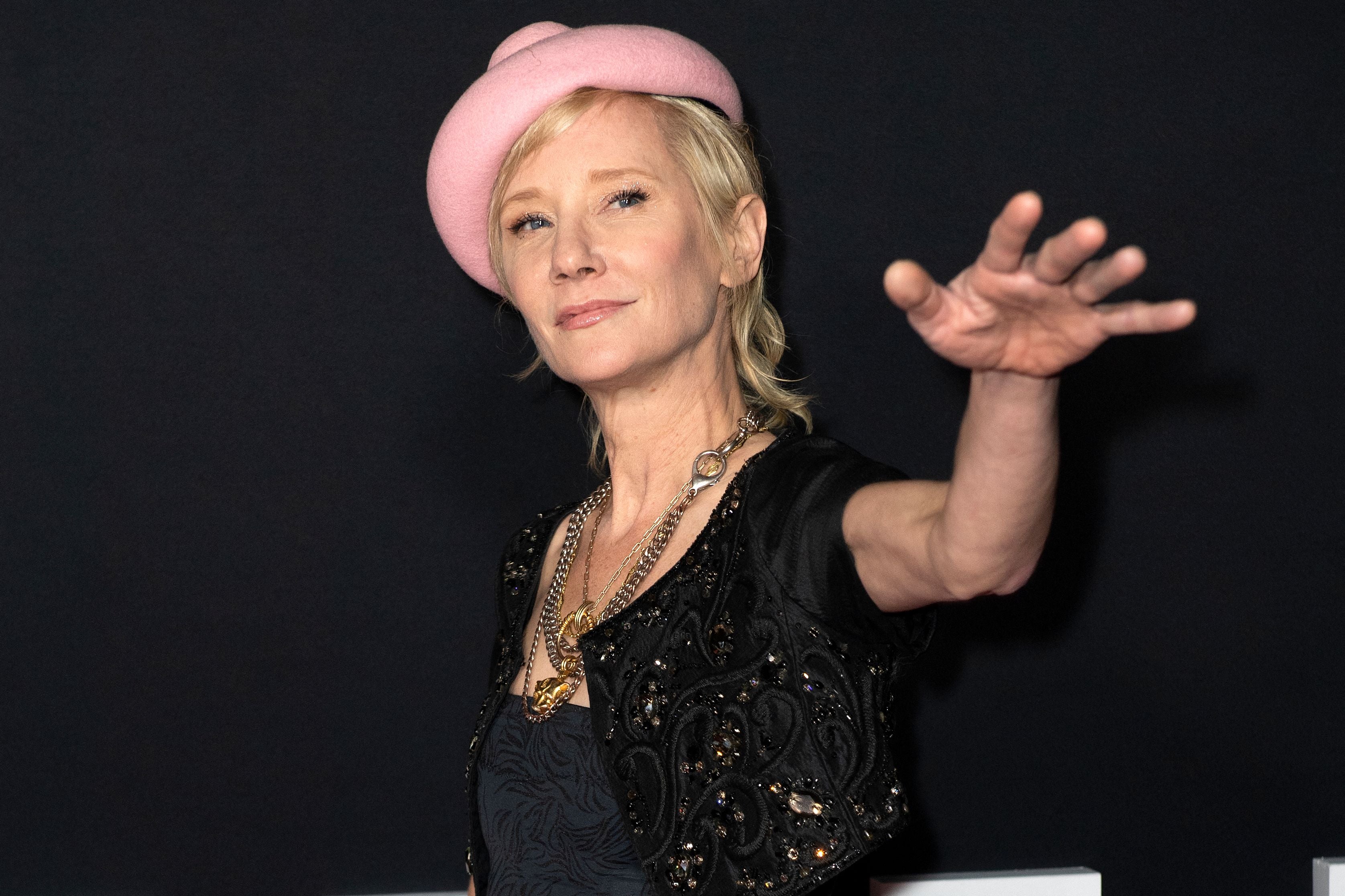 Representantes de Anne Heche ahora dicen que la actriz está “inconsciente” y en “grave estado” tras accidente