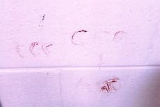 Inquietantes fotos muestran que Nikolas Cruz escribió “666” con su propia sangre en las paredes de su celda