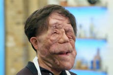 El concursante de ‘Celebrity MasterChef’, Adam Pearson, emite una disculpa “sarcástica” a los espectadores