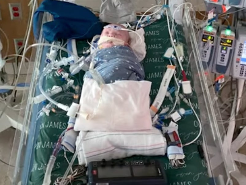 El primer trasplante parcial de corazón de “tejido vivo” salva a recién nacido