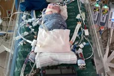 El primer trasplante parcial de corazón de “tejido vivo” salva a recién nacido