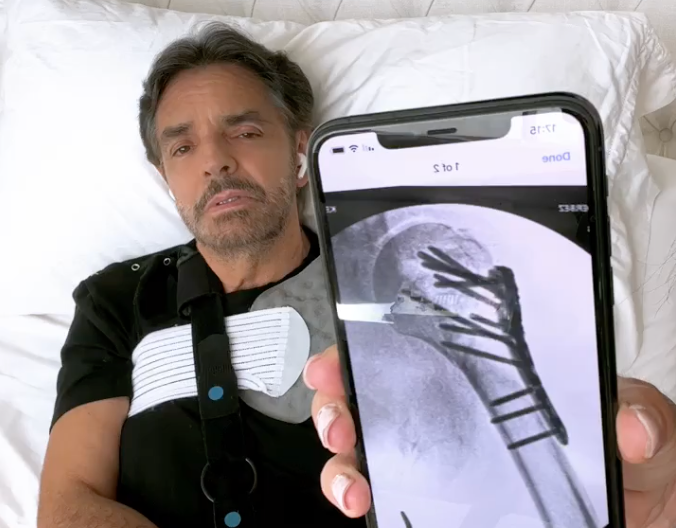 “Se fueron a los golpes”: Fractura de Eugenio Derbez habría sido causada por “pelea con su hijo Vadhir”