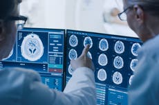 Neurocirujano revela cinco cosas a evitar para tener un cerebro sano