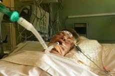 Amputan extremidades a mujer después de desarrollar sepsis por ITU común