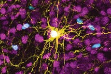 Investigadores cultivan células cerebrales humanas en ratas