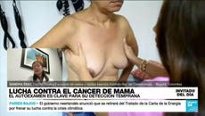 Los avances más recientes en la lucha contra el cáncer de mama