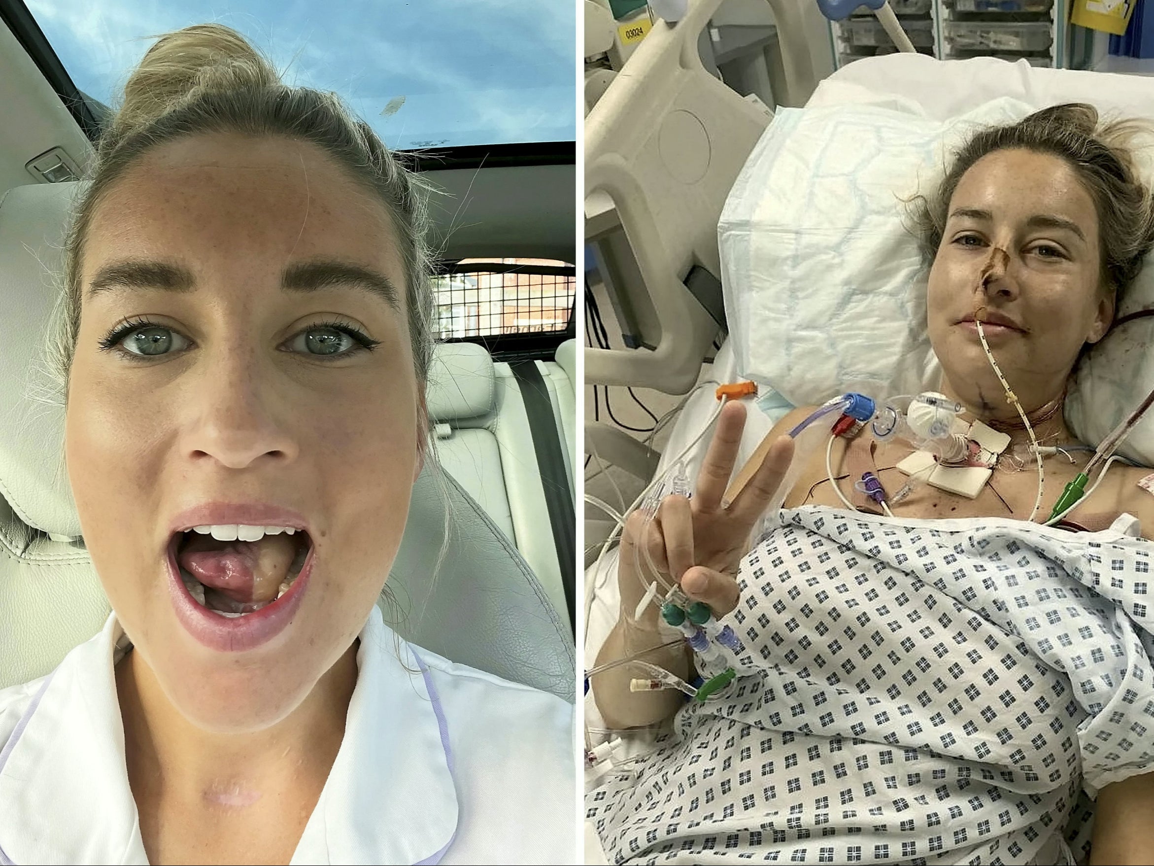 Las causas del cáncer de boca crecen a medida que los casos se disparan en el Reino Unido