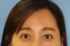 Washington: mujer logra llamar al 911 antes de que su exmarido la secuestrara y enterrara viva