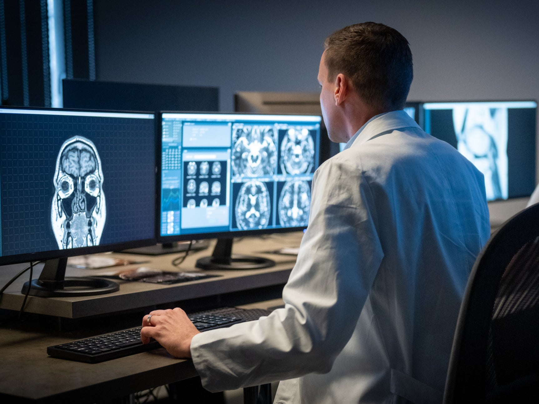 ¿Cuáles son los siete posibles síntomas a tener en cuenta del cáncer de cerebro? 