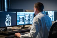 ¿Cuáles son los siete posibles síntomas a tener en cuenta del cáncer de cerebro?