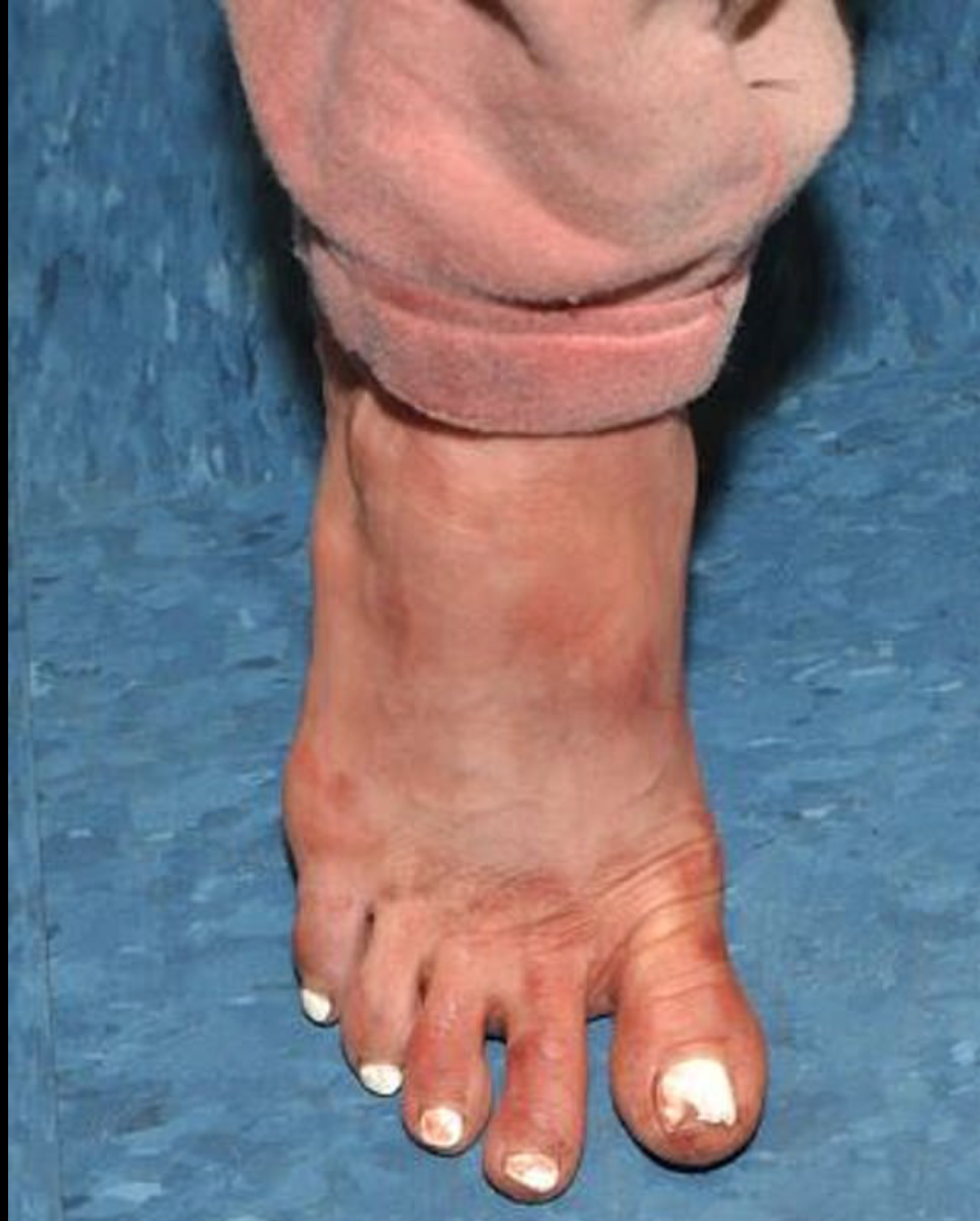 Los pies de Courtney Clenney estaban impregnados de sangre tras el apuñalamiento, según las autoridades