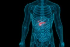 14 síntomas de cáncer de páncreas que es más probable que ignores