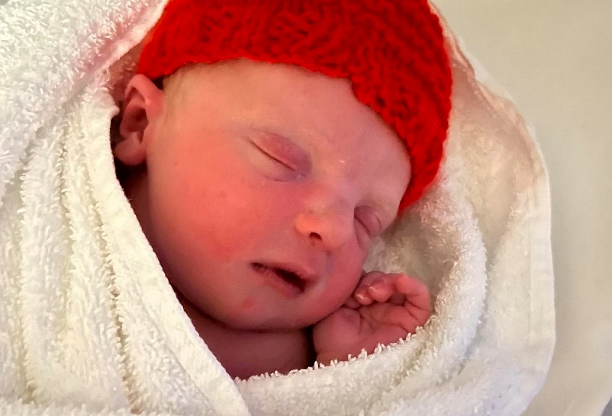 Diagnostican raro síndrome a un bebé porque su madre se dio cuenta de que no se parecía en nada a ella