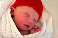 Diagnostican raro síndrome a un bebé porque su madre se dio cuenta de que no se parecía en nada a ella