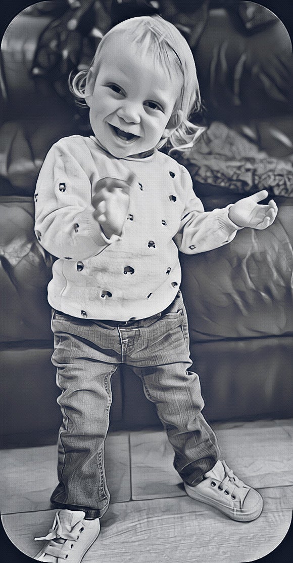 Dr. Harris nos explica de qué se trata la rara enfermedad del Síndrome de Kabuki