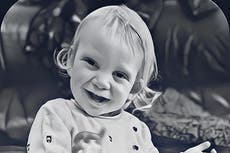 Dr. Harris nos explica de qué se trata la rara enfermedad del Síndrome de Kabuki