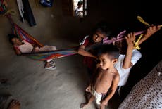 Colombia registra muerte de 308 niños por desnutrición