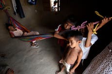 Colombia registra muerte de 308 niños por desnutrición