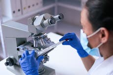 Nueve virus que preocupan a la Organización Mundial de la Salud