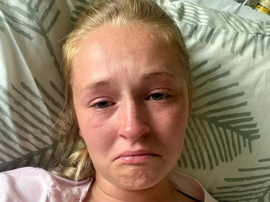 Médicos del Reino Unido le dijeron a una joven que solo tenía estrés; resultó ser cáncer en etapa cuatro