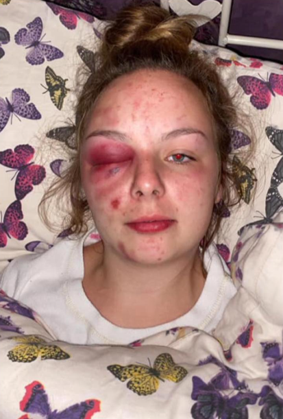 Imagen difundida de las lesiones, autoinfligidas, que sufrió Eleanor Williams