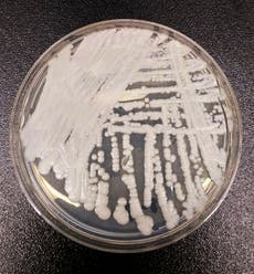 Aumentan casos de superbacteria en EEUU durante pandemia