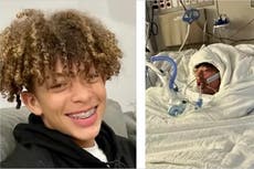 Desafío de TikTok deja a un adolescente “irreconocible” con quemaduras en casi 80% del cuerpo