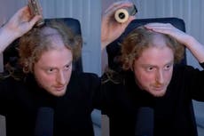 Streamer descubre una hendidura en la cabeza por el uso prolongado de auriculares