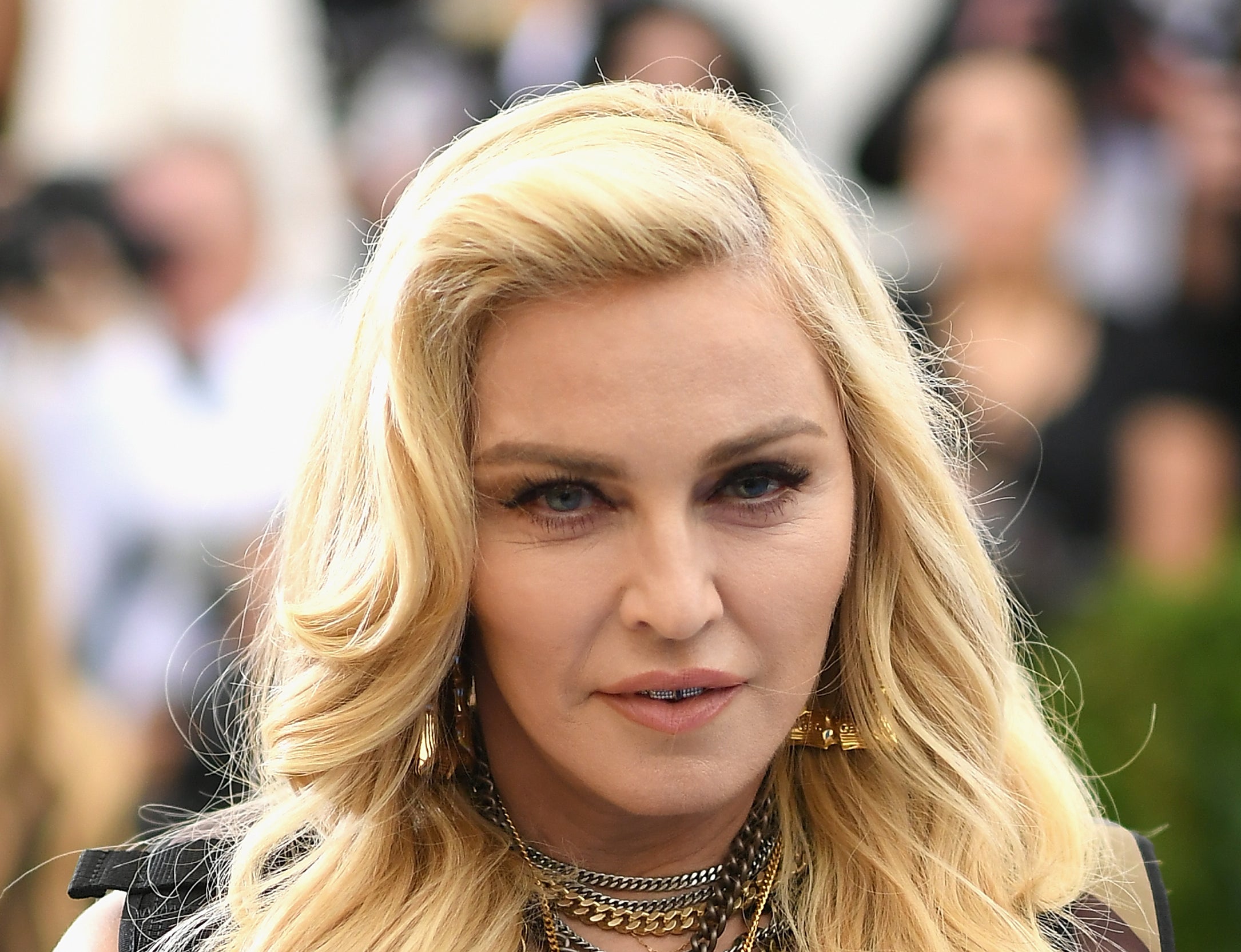 Madonna sigue recibiendo atención médica, dijo su representante de gira