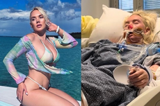 Modelo pierde una pierna tras infectarse con la bacteria “comecarne”. Pero, ¿qué es y cómo evitarla?