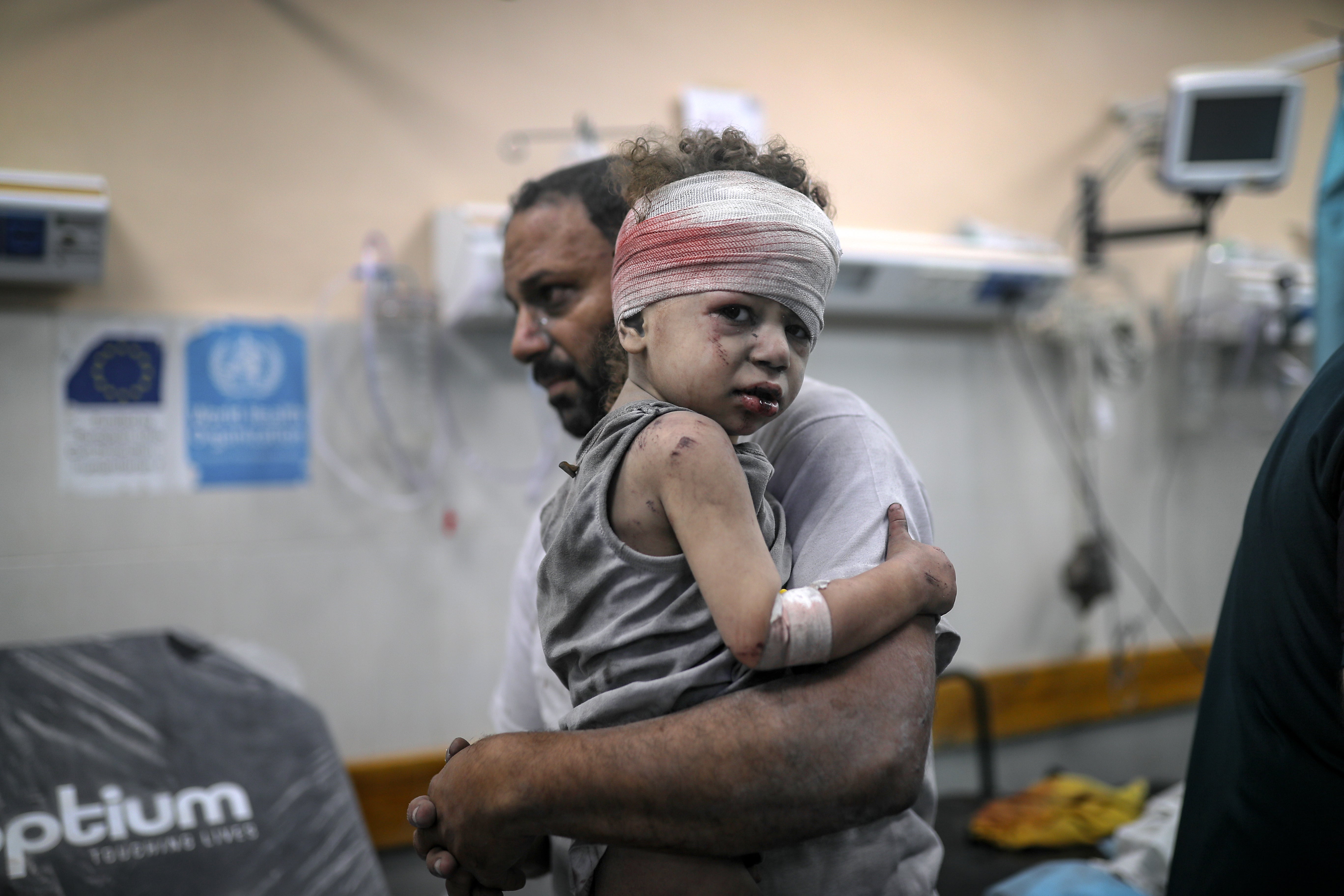 Un niño lesionado llega al hospital Nassr tras los ataques aéreos israelíes en el sur de Gaza