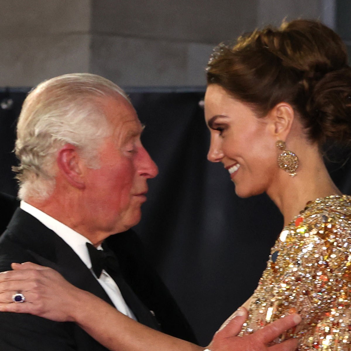 En el Reino Unido creen que la operación de Kate Middleton es realmente más grave de lo que cuentan 11 Merca2.es Pero, no se indica la razón de la intervención abdominal de Kate Middleton