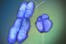 Enfermedades autoinmunes atacan más a mujeres que hombres: claves sobre el motivo