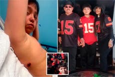 Un niño de 10 años recibió un disparo en el festejo del Super Bowl