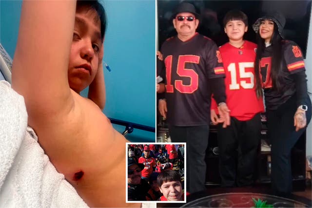 <p>Samuel Arellano (10) fue uno de los 22 heridos de bala en la tragedia del desfile de los Kansas City Chiefs que le costó la vida a una <em>DJ</em> de una radio local.</p>