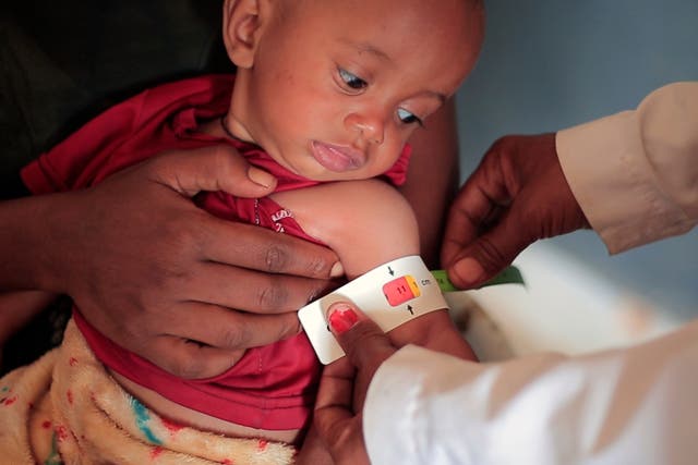 <p>Una enfermera mide la circunferencia del brazo (perímetro braquial) de Temesgen Muluhaw, un niño de ocho meses que sufre desnutrición, en Mai Mekden, en el centro de salud Finarwa de Mai Mekden, en la región de Tigray, al norte de Etiopía, el 27 de febrero de 2024</p>