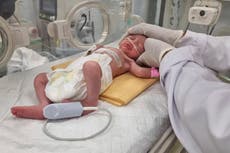 Bebé palestina en Gaza nace huérfana en cesárea de emergencia tras ataque israelí