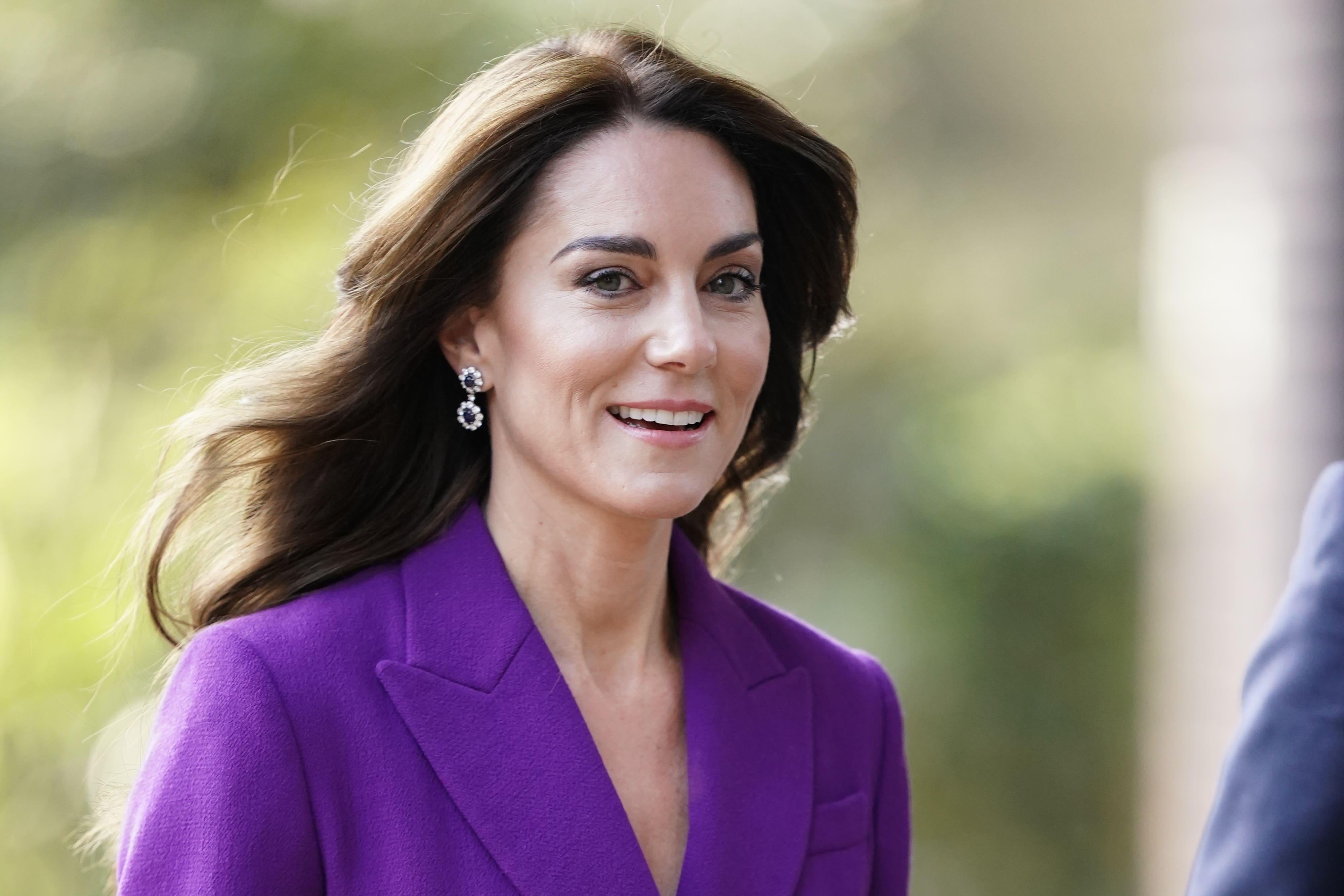 La princesa de Gales se somete a un tratamiento contra el cáncer