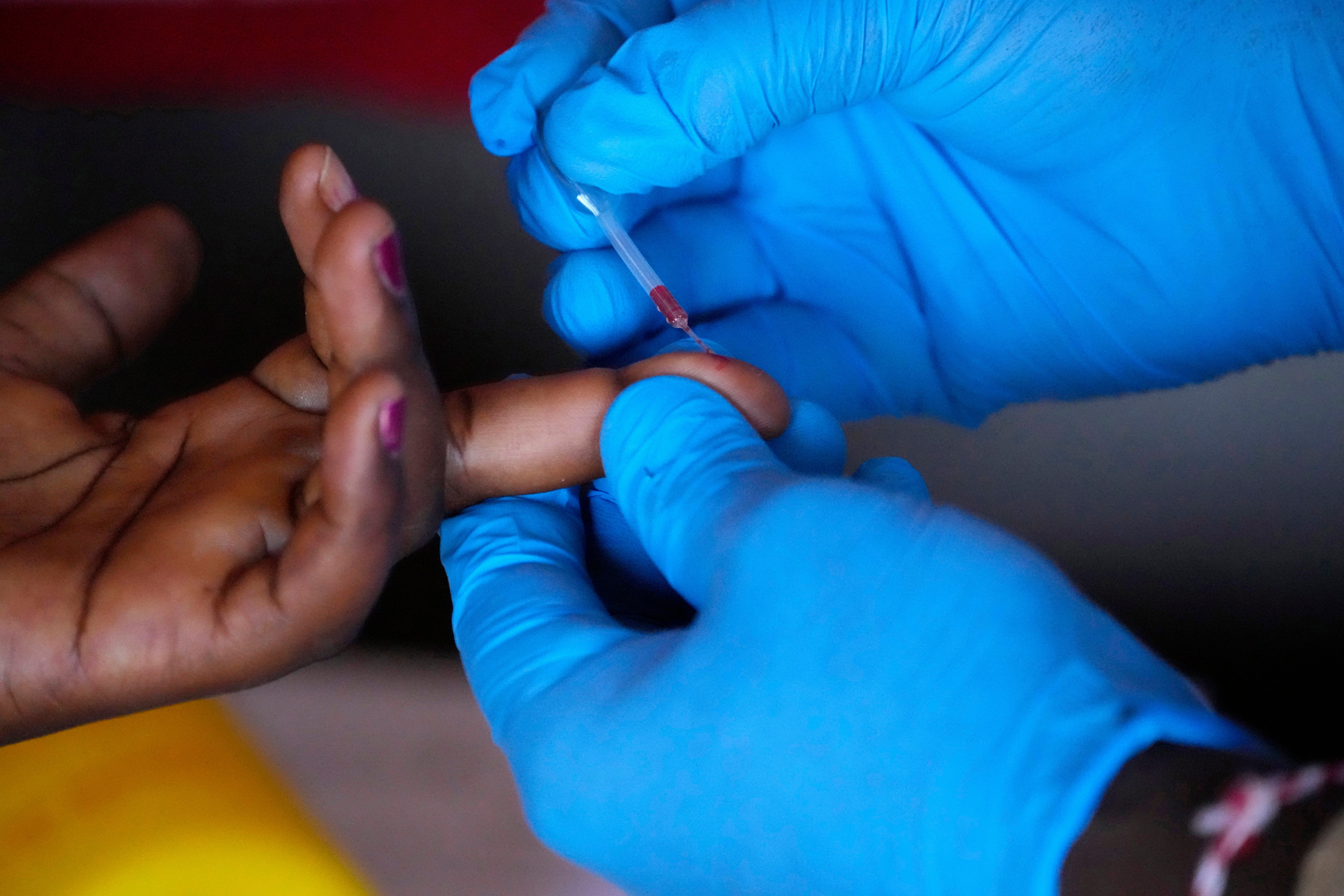 AFR-GEN SUDÁFRICA-CURANDEROS-VIH