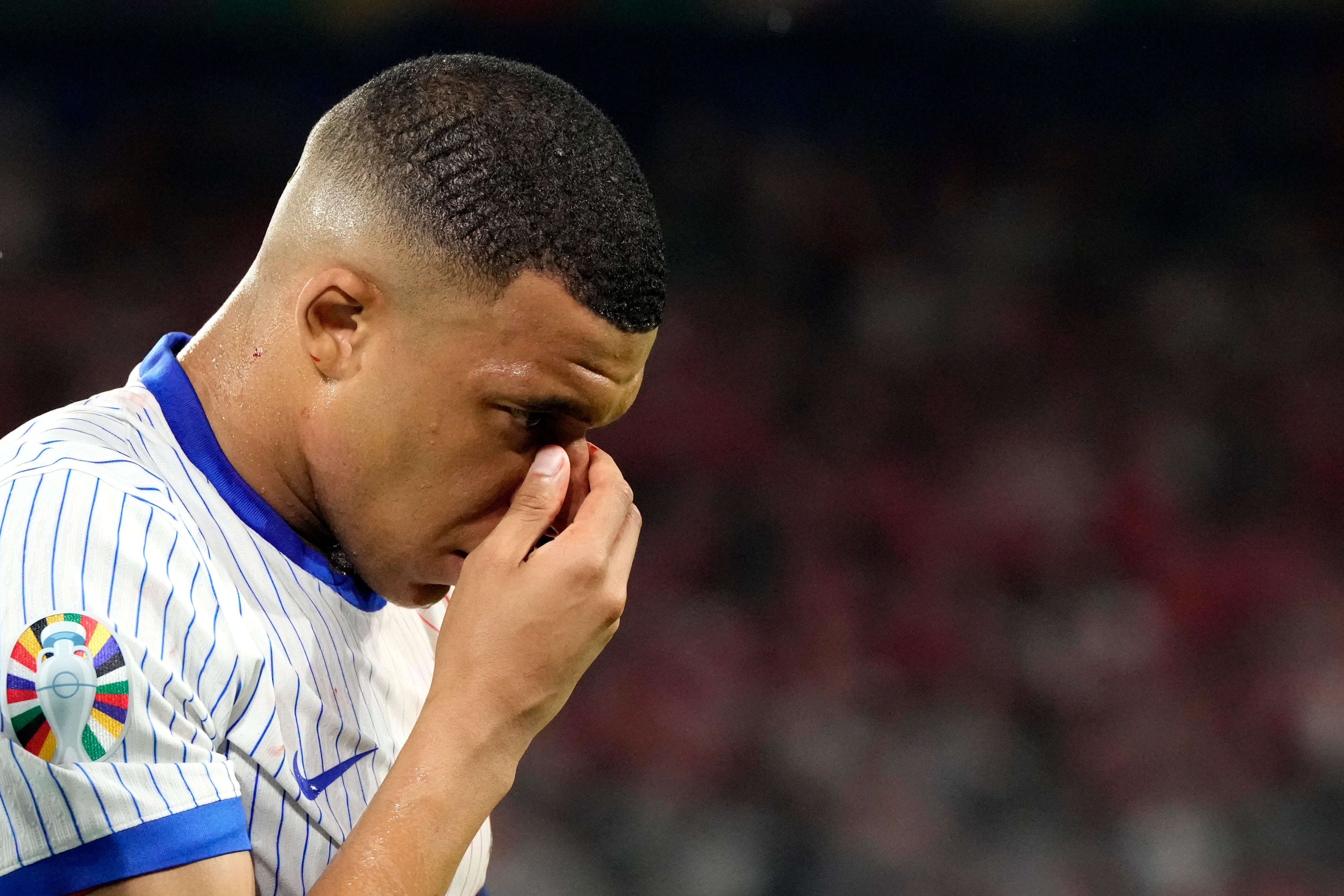 Mbappé Sufrió Una Fractura En La Nariz En La Euro 2024 Y Usará Una ...