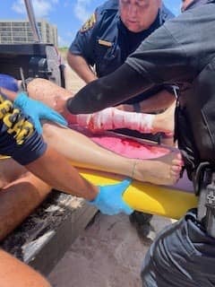 Dos agentes fuera de servicio de la Patrulla Fronteriza de la Unidad de Búsqueda, Trauma y Rescate prestan ayuda a una víctima de ataque de tiburón en la Isla del Padre.