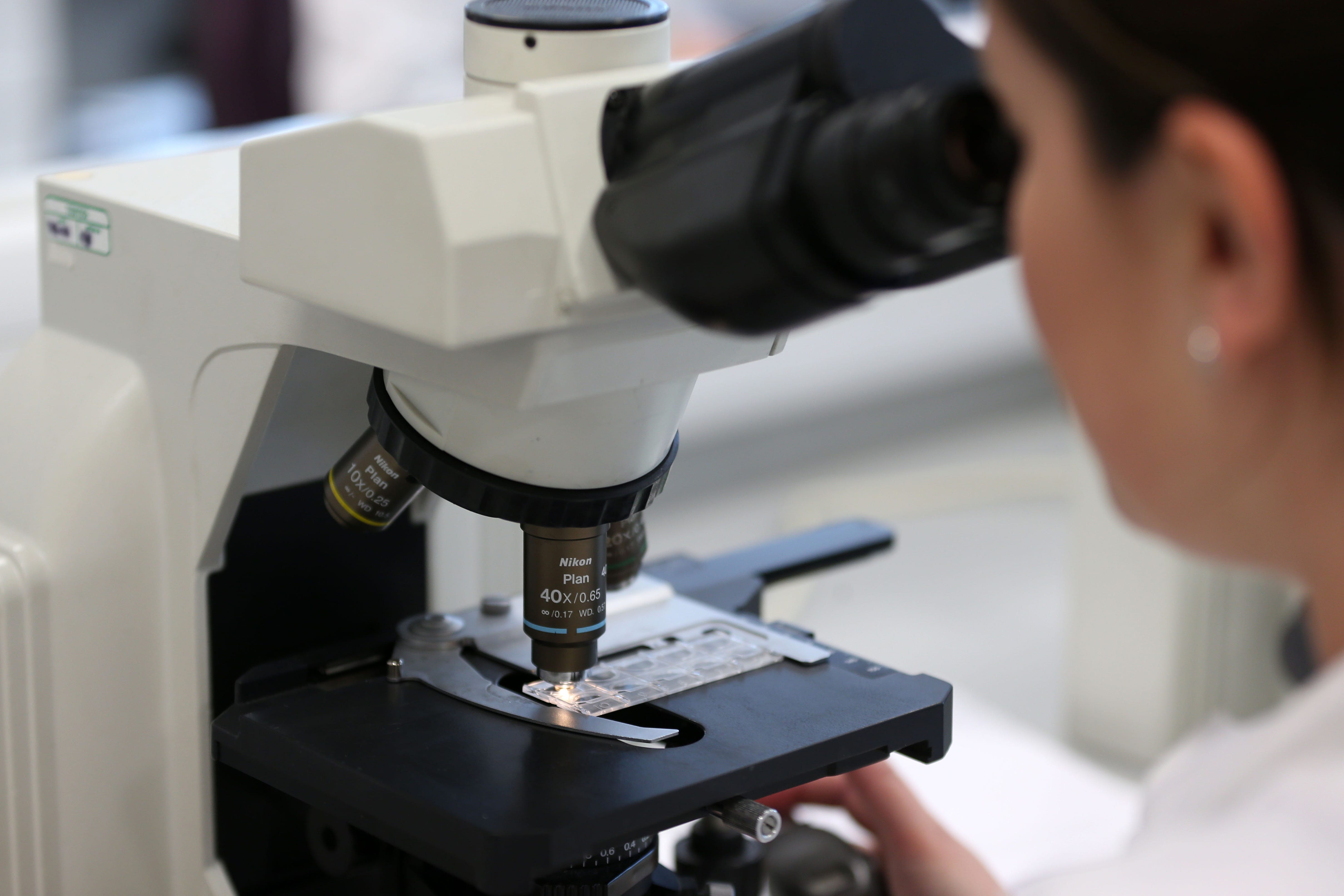El equipo, financiado por el ICR y Breast Cancer Now, también cultivó en laboratorio minitumores diseñados para modelar el comportamiento del cáncer en el cuerpo humano