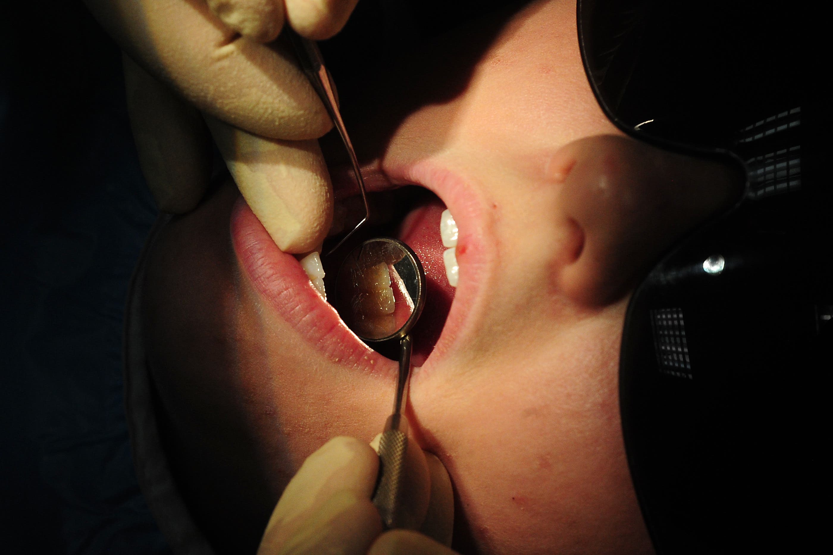 El estudio afirma que los dientes de los niños actúan como pequeñas cápsulas del tiempo