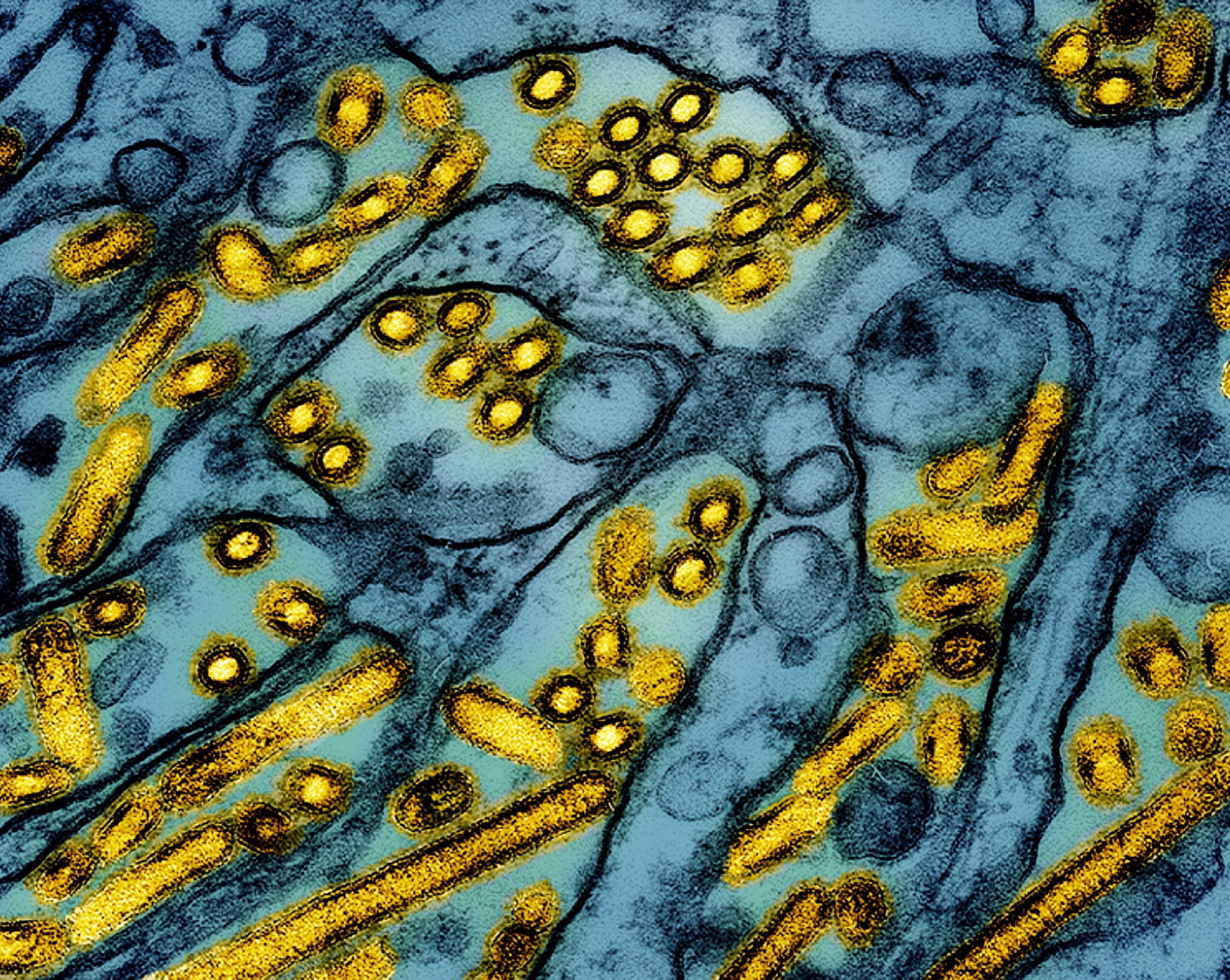 Una imagen de microscopio electrónico coloreada muestra partículas del virus H5N1. El aumento de los casos hace que algunas personas recuerden el brote de gripe H1N1 de 2009