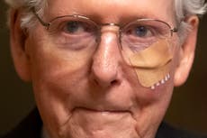 McConnell ausente mientras se recupera de una caída en el Capitolio