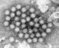 El norovirus regresa con fuerza y los casos en Estados Unidos aumentan notablemente