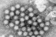 El norovirus regresa con fuerza y los casos en Estados Unidos aumentan notablemente