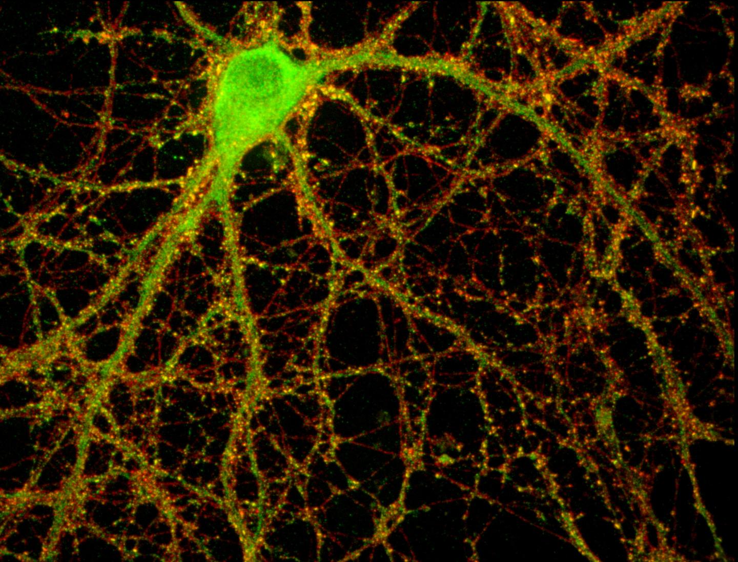 Una neurona del hipocampo de un ratón repleta de conexiones sinápticas