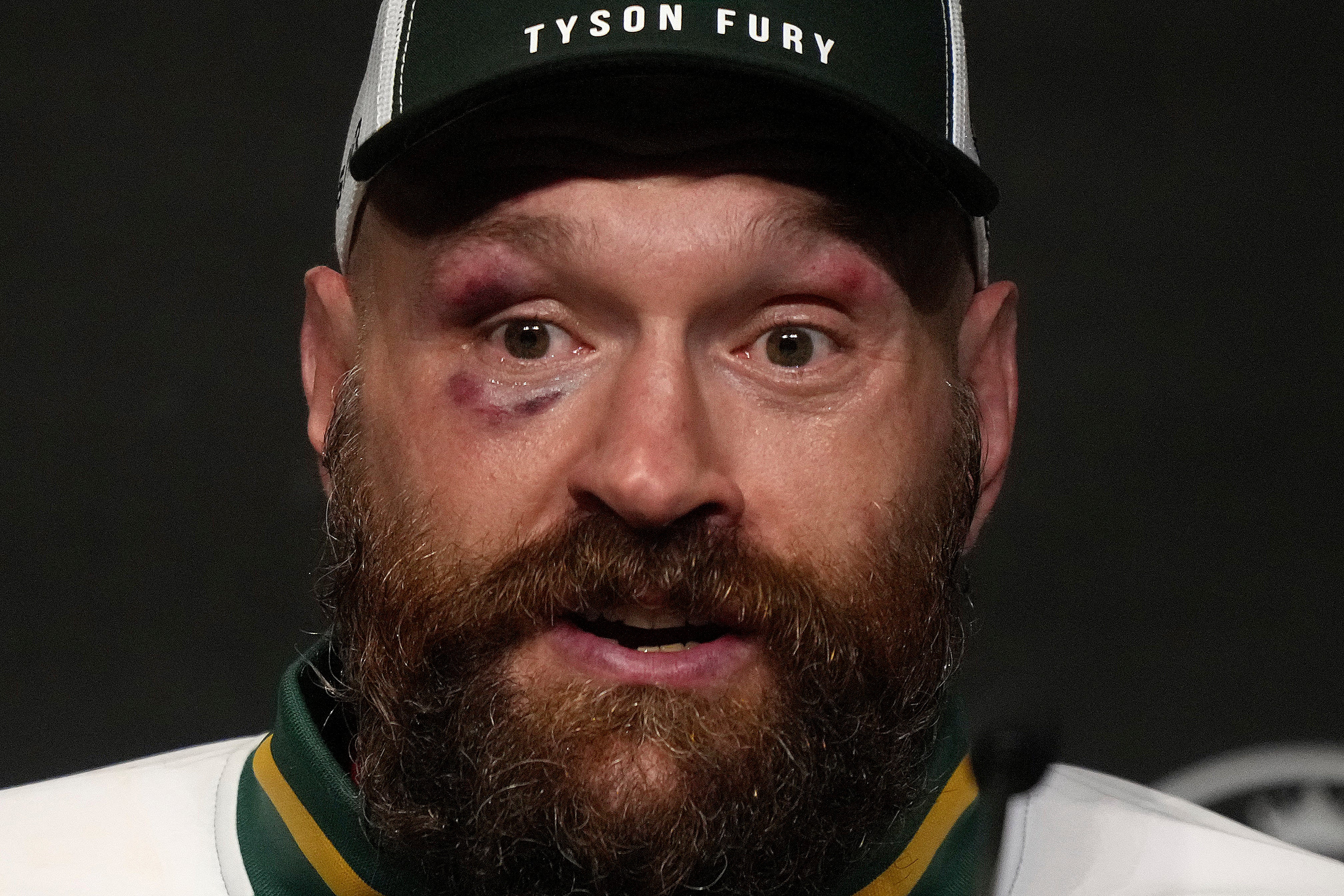 TYSON FURY