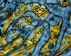 Nueva York cierra temporalmente mercados de aves tras detectar casos de gripe aviar